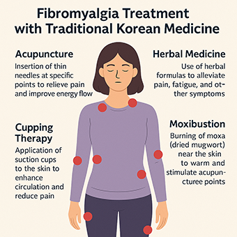 fibromyalgia treatment